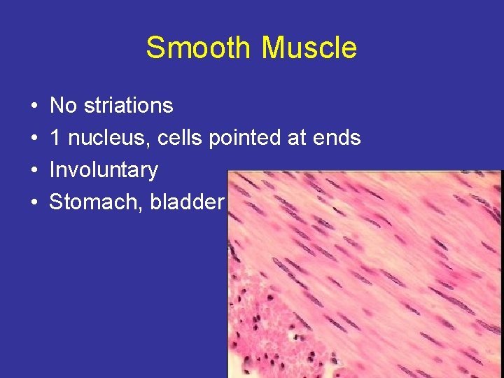 Smooth Muscle • • No striations 1 nucleus, cells pointed at ends Involuntary Stomach,