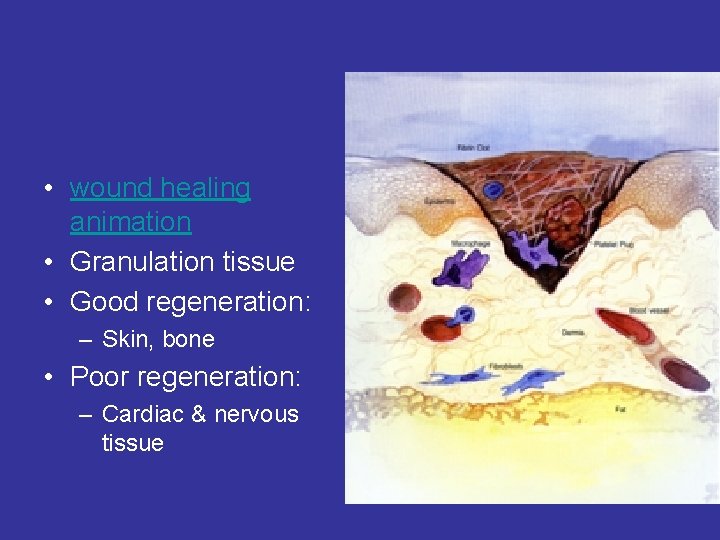  • wound healing animation • Granulation tissue • Good regeneration: – Skin, bone