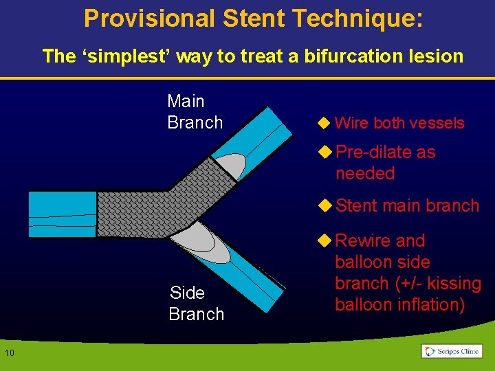 Provisional Stent Technique: The ‘simplest’ way to treat a bifurcation lesion Main Branch u