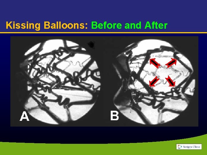 Kissing Balloons: Before and After 