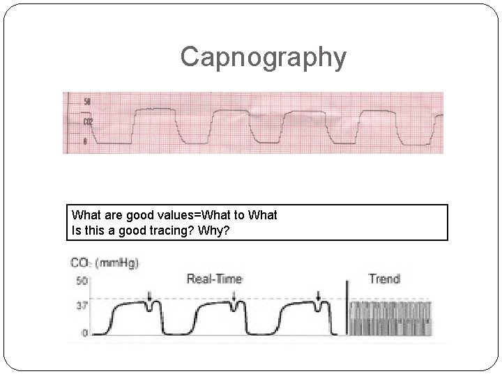 Capnography What are good values=What to What Is this a good tracing? Why? 