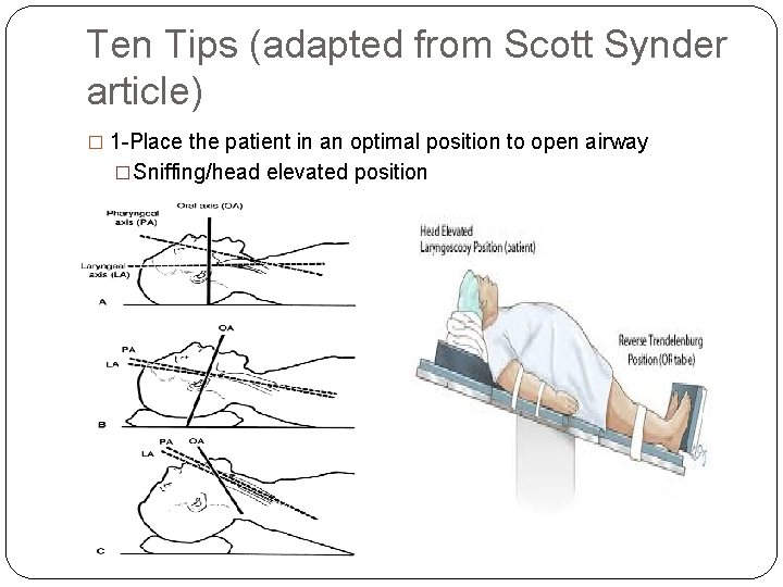 Ten Tips (adapted from Scott Synder article) � 1 -Place the patient in an