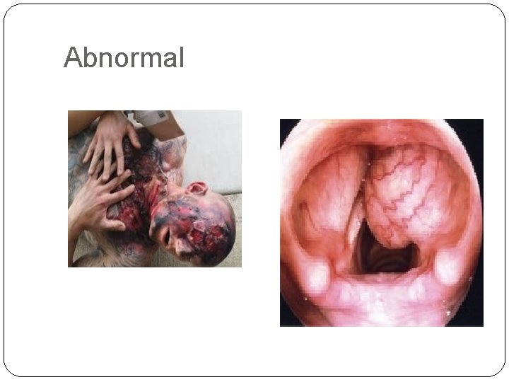 Abnormal 