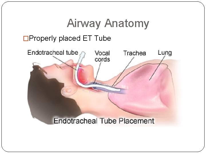 Airway Anatomy �Properly placed ET Tube 