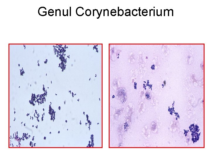 Genul Corynebacterium 