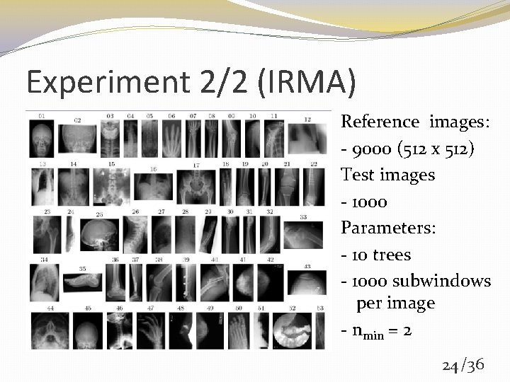 Experiment 2/2 (IRMA) Reference images: - 9000 (512 x 512) Test images - 1000