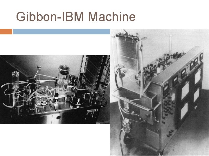 Gibbon-IBM Machine 