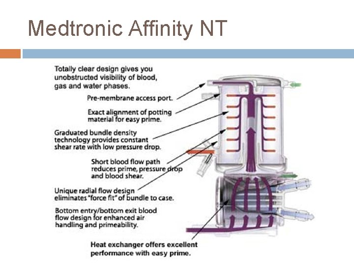 Medtronic Affinity NT 