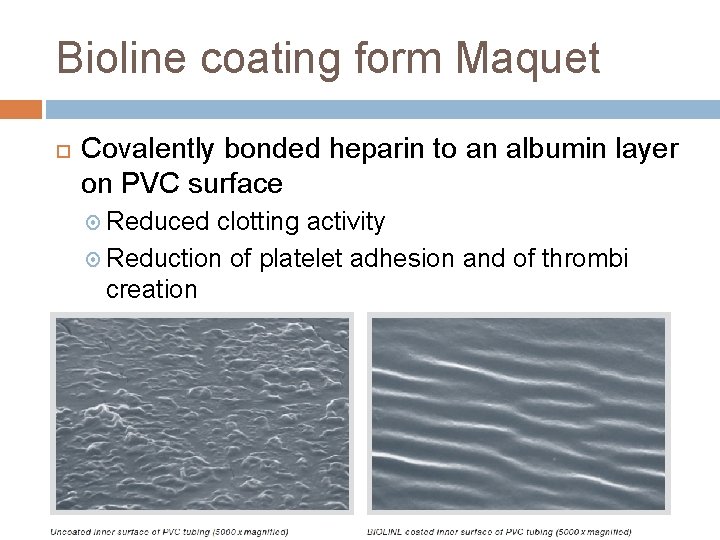 Bioline coating form Maquet Covalently bonded heparin to an albumin layer on PVC surface