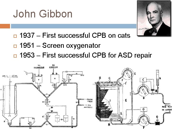 John Gibbon 1937 – First successful CPB on cats 1951 – Screen oxygenator 1953