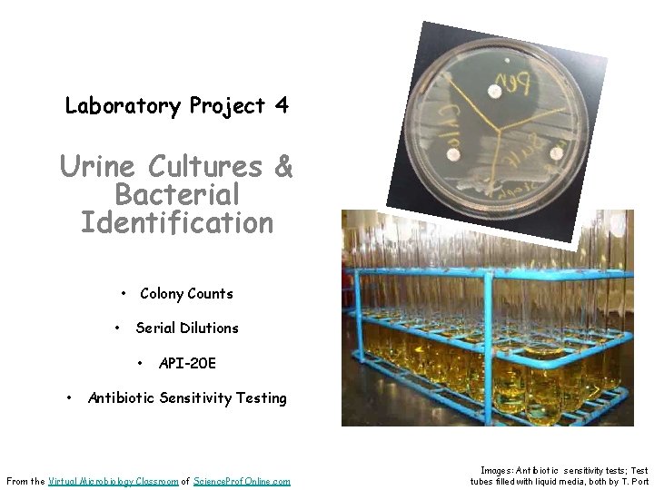 Laboratory Project 4 Urine Cultures & Bacterial Identification • • Colony Counts Serial Dilutions