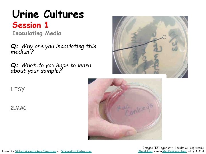 Urine Cultures Session 1 Inoculating Media Q: Why are you inoculating this medium? Q: