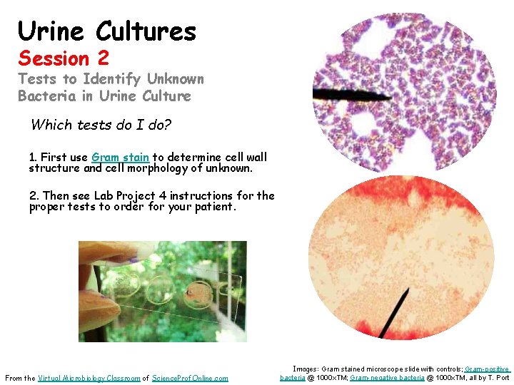 Urine Cultures Session 2 Tests to Identify Unknown Bacteria in Urine Culture Which tests