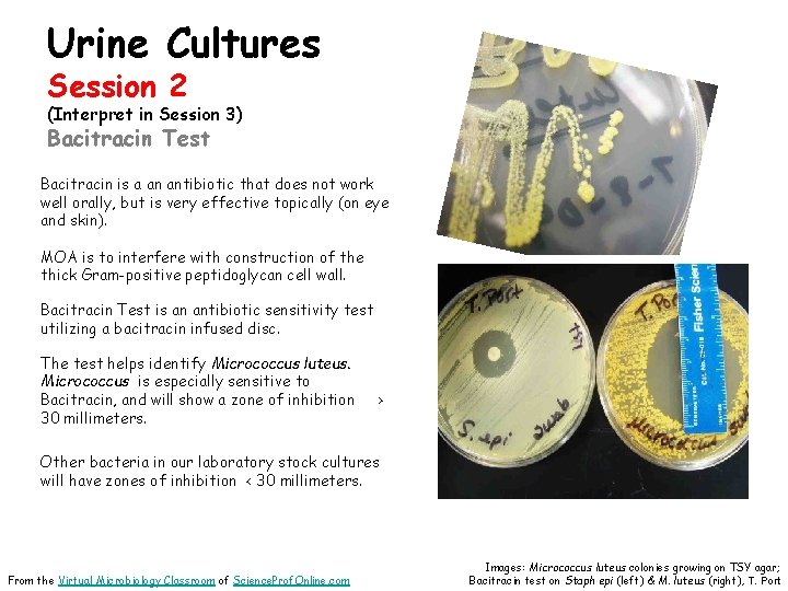 Urine Cultures Session 2 (Interpret in Session 3) Bacitracin Test Bacitracin is a an