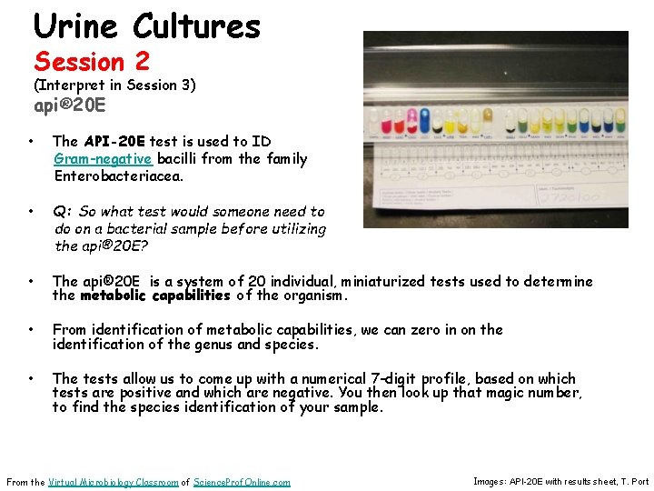 Urine Cultures Session 2 (Interpret in Session 3) api® 20 E • The API-20