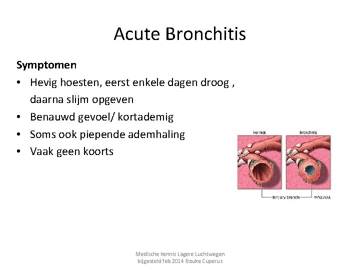 Acute Bronchitis Symptomen • Hevig hoesten, eerst enkele dagen droog , daarna slijm opgeven