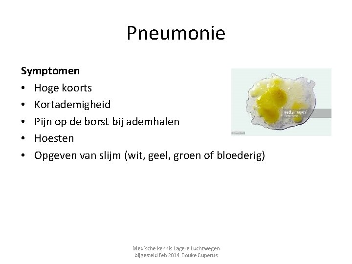 Pneumonie Symptomen • Hoge koorts • Kortademigheid • Pijn op de borst bij ademhalen