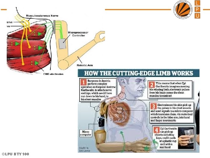 ©LPU BTY 100  ©LPU BTY 100