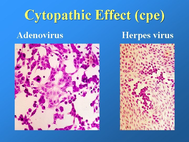 Cytopathic Effect (cpe) Adenovirus Herpes virus 