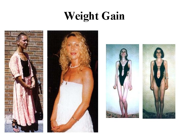 Weight Gain 