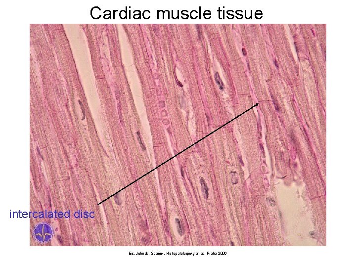 Cardiac muscle tissue intercalated disc Eis, Jelínek, Špaček, Histopatologický atlas, Praha 2006 