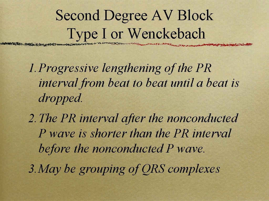 Second Degree AV Block Type I or Wenckebach 1. Progressive lengthening of the PR
