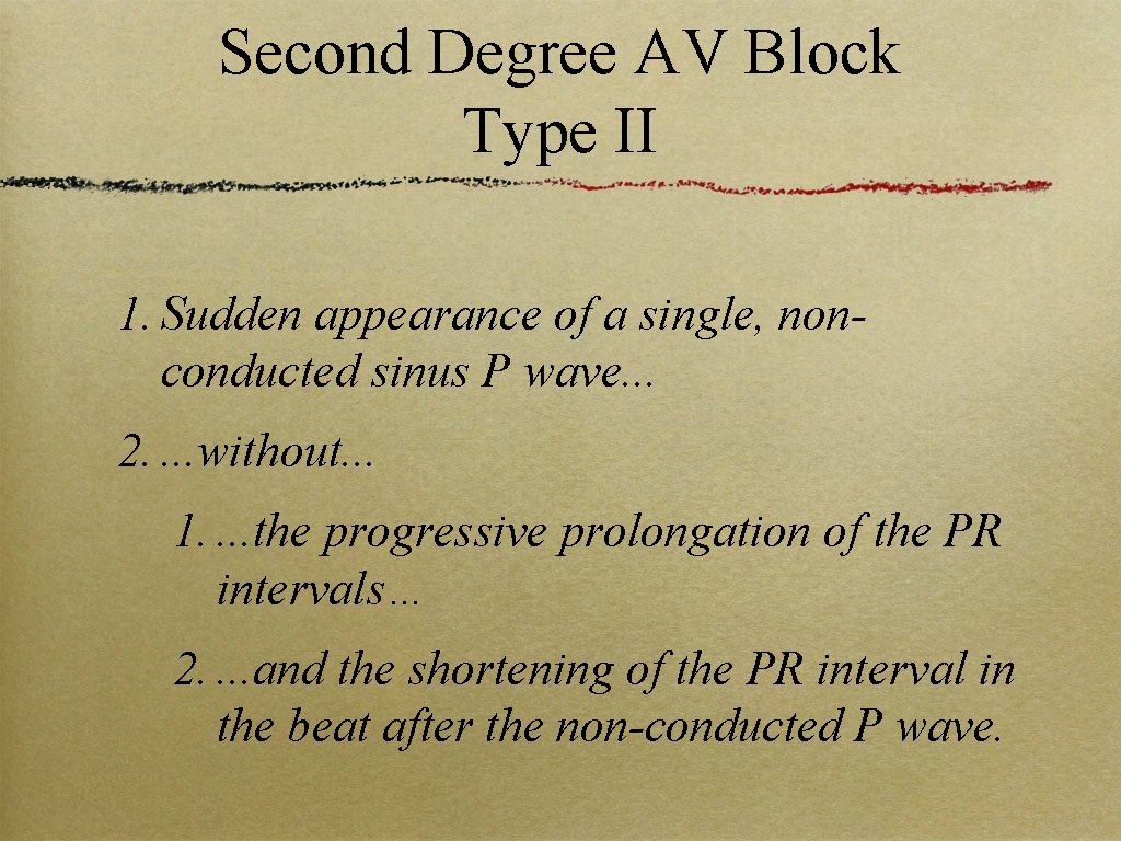 Second Degree AV Block Type II 1. Sudden appearance of a single, nonconducted sinus