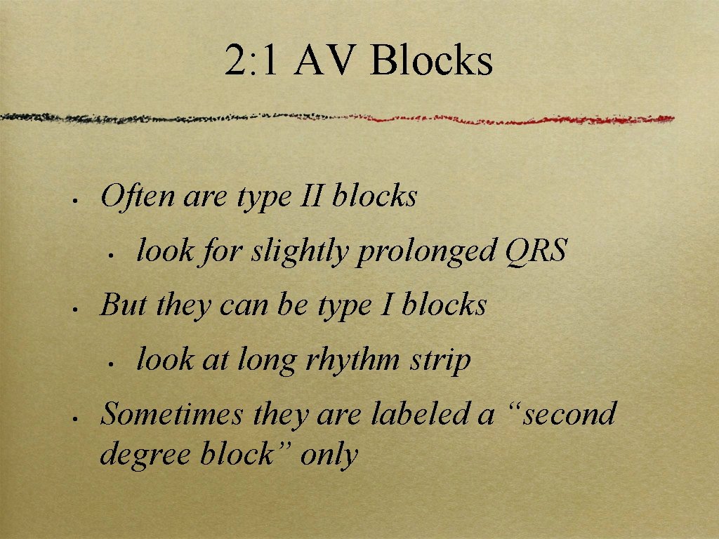 2: 1 AV Blocks • Often are type II blocks • • But they