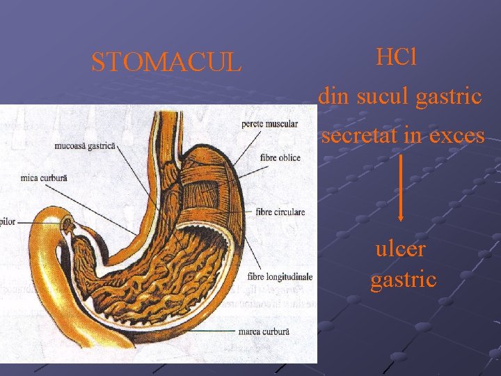 STOMACUL HCl din sucul gastric secretat in exces ulcer gastric 