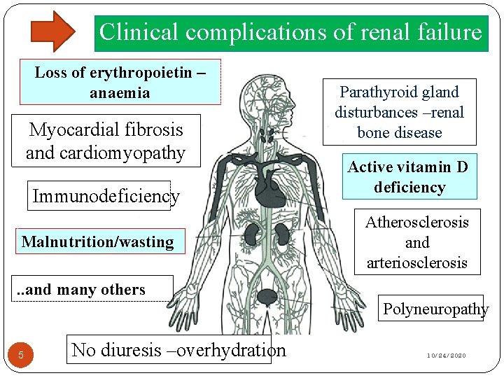 Clinical complications of renal failure Loss of erythropoietin – anaemia Myocardial fibrosis and cardiomyopathy
