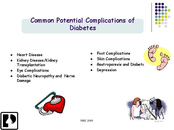 Common Potential Complications of Diabetes l l Heart Disease Kidney Disease/Kidney Transplantation Eye Complications