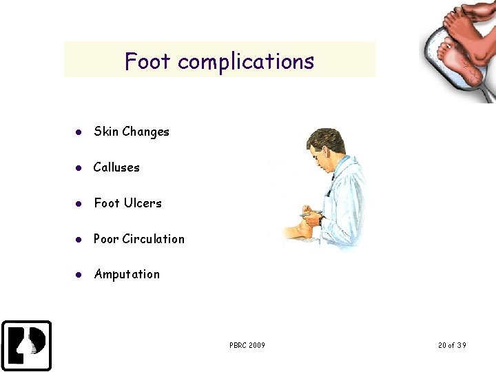 Foot complications l Skin Changes l Calluses l Foot Ulcers l Poor Circulation l