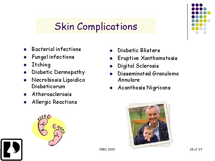 Skin Complications l l l l Bacterial infections Fungal infections Itching Diabetic Dermopathy Necrobiosis