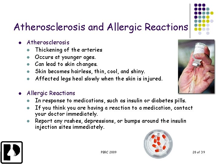 Atherosclerosis and Allergic Reactions l Atherosclerosis l l l Thickening of the arteries Occurs