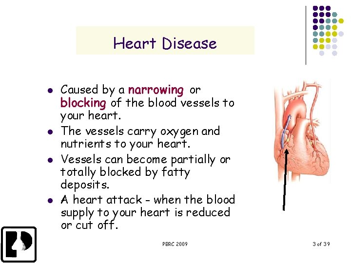 Heart Disease l l Caused by a narrowing or blocking of the blood vessels