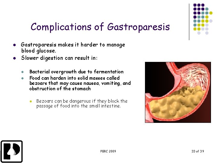 Complications of Gastroparesis l l Gastroparesis makes it harder to manage blood glucose. Slower