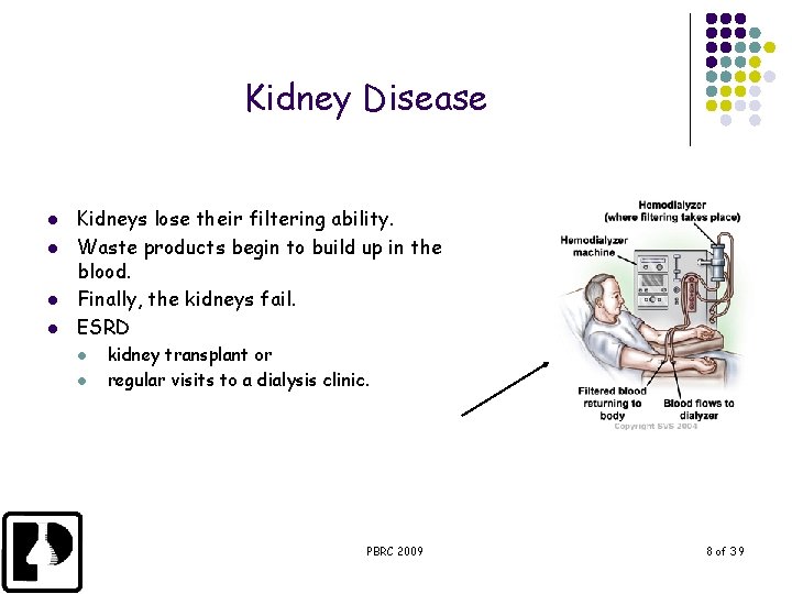 Kidney Disease l l Kidneys lose their filtering ability. Waste products begin to build