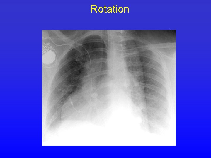 Rotation 