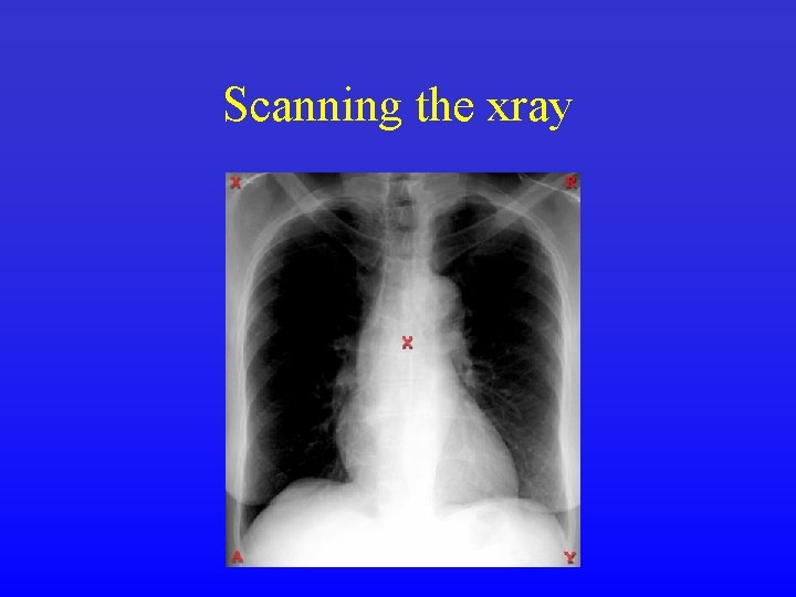 Scanning the xray 