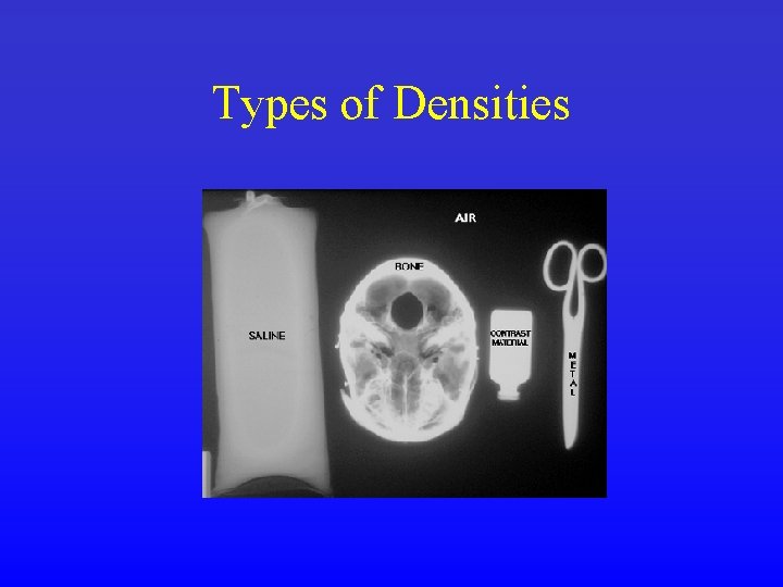 Types of Densities 