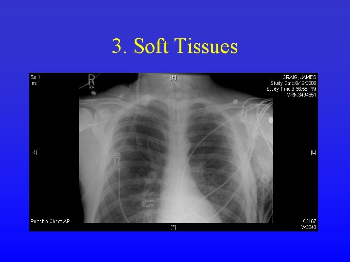 3. Soft Tissues 