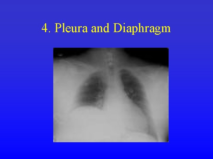 4. Pleura and Diaphragm 