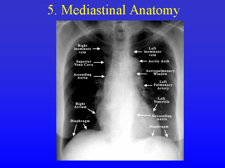 5. Mediastinal Anatomy 
