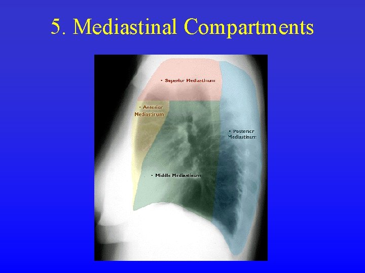 5. Mediastinal Compartments 