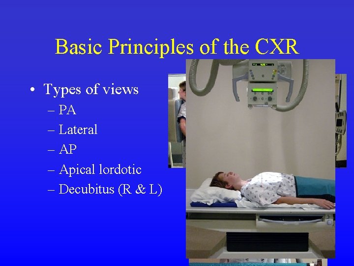 Basic Principles of the CXR • Types of views – PA – Lateral –