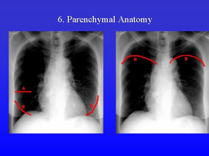6. Parenchymal Anatomy 