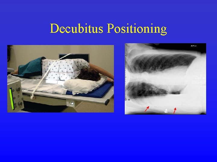 Decubitus Positioning 