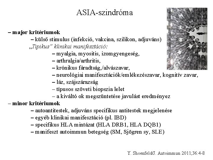 ASIA-szindróma – major kritériumok – külső stimulus (infekció, vakcina, szilikon, adjuváns) „Tipikus” klinikai manifesztáció: