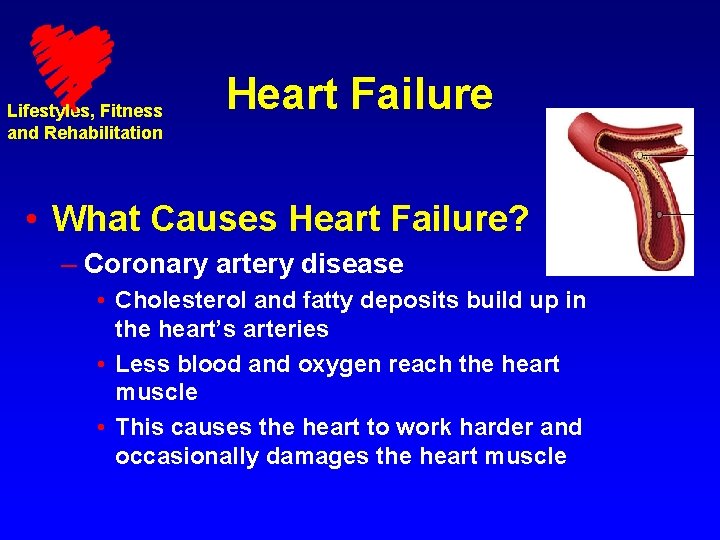 Lifestyles, Fitness and Rehabilitation Heart Failure • What Causes Heart Failure? – Coronary artery