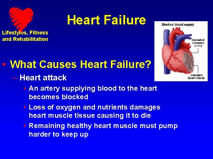 Heart Failure Lifestyles, Fitness and Rehabilitation • What Causes Heart Failure? – Heart attack